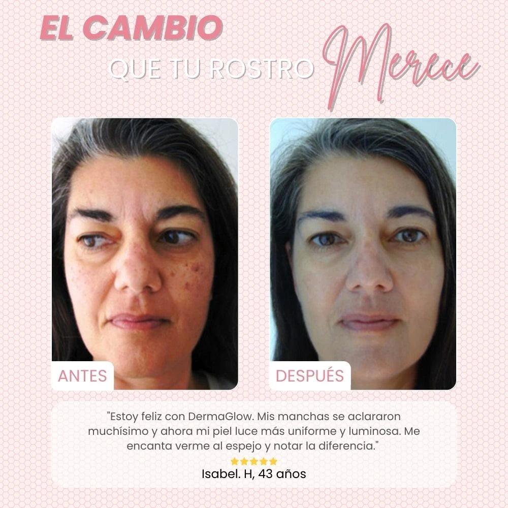 DERMAGLOW™ | TRANSFORMA TU ROSTRO, SIN MANCHAS, ARRUGAS NI ACNÉ EN UNA SEMANA