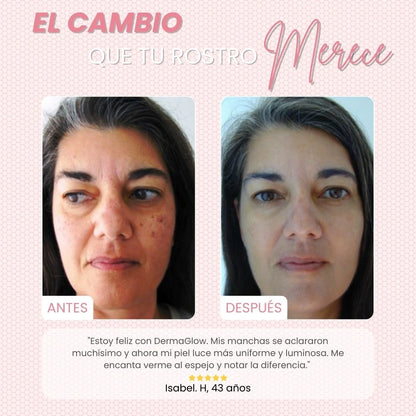 DERMAGLOW™ | TRANSFORMA TU ROSTRO, SIN MANCHAS, ARRUGAS NI ACNÉ EN UNA SEMANA