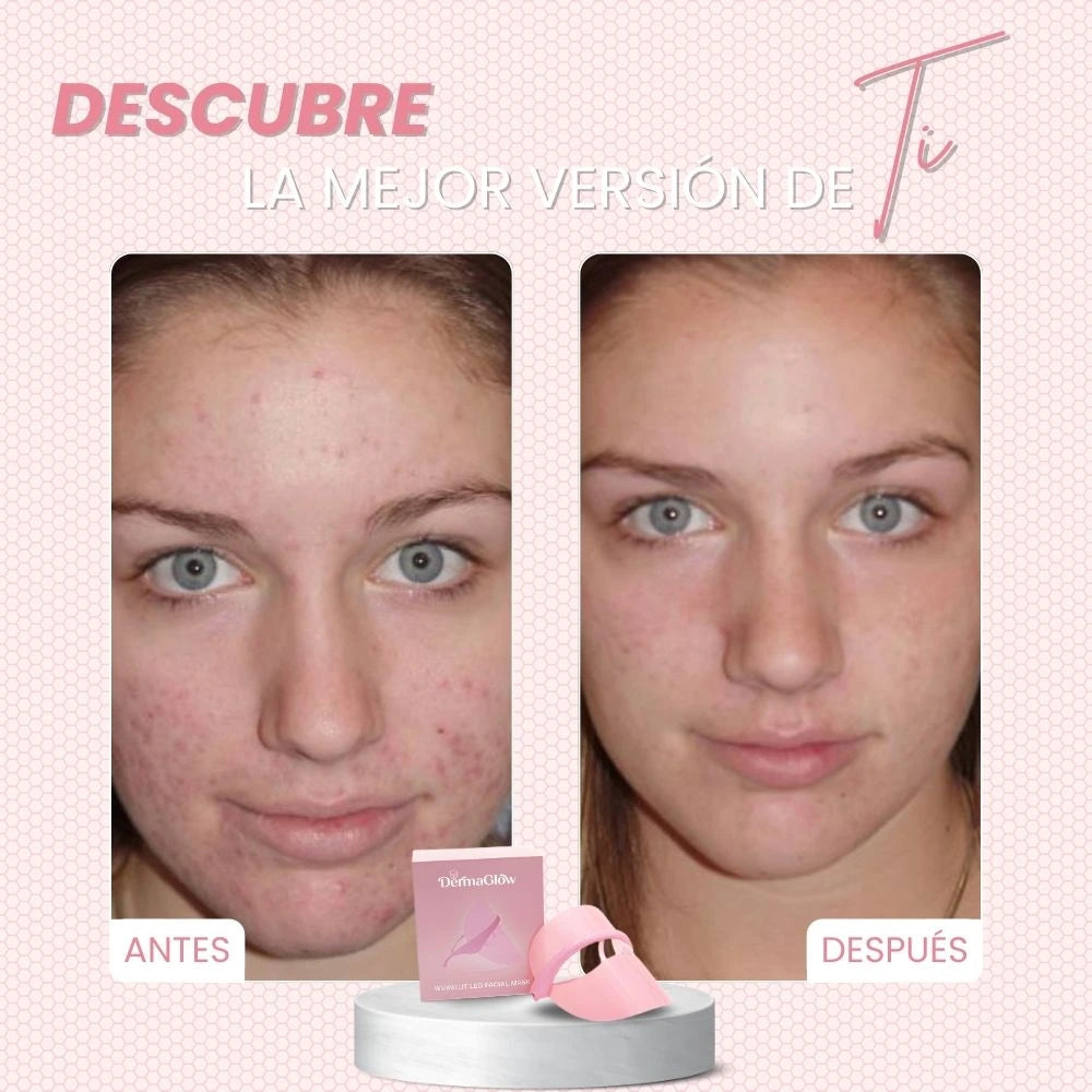 DERMAGLOW™ | TRANSFORMA TU ROSTRO, SIN MANCHAS, ARRUGAS NI ACNÉ EN UNA SEMANA