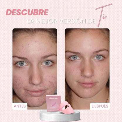 DERMAGLOW™ | TRANSFORMA TU ROSTRO, SIN MANCHAS, ARRUGAS NI ACNÉ EN UNA SEMANA